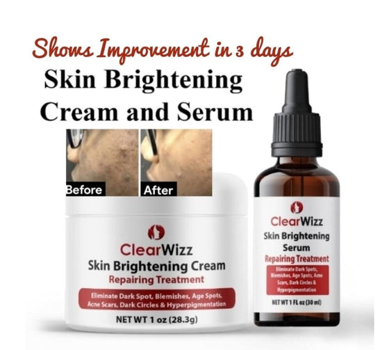 Skin Brightening Cream | Inner Thigh | Under Arm | Skin Discoloration Blemishes Corrector | Dark Spot Remover cream 1 oz + 1 oz serum - GoodBrands USA 