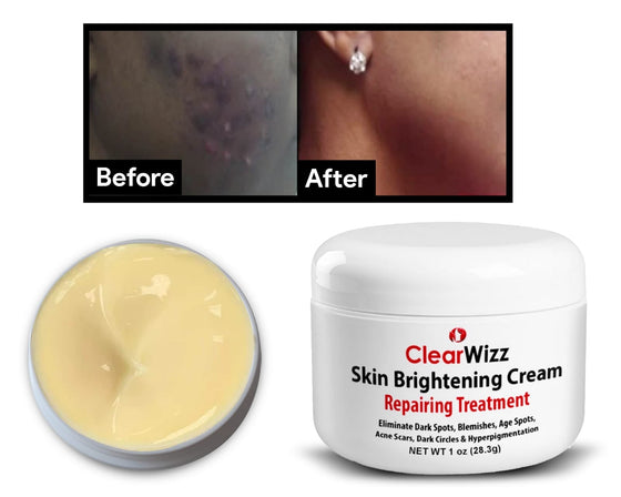 ClearWizz Skin brightening Cream 2 oz